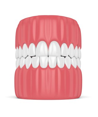 çene maloklüzyon underbite ile 3D render. Üst dişler alt dişleri arkasında