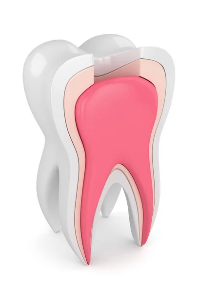 Renderização Dente Com Procedimento Tratamento Canal Radicular Sobre Fundo Branco — Fotografia de Stock