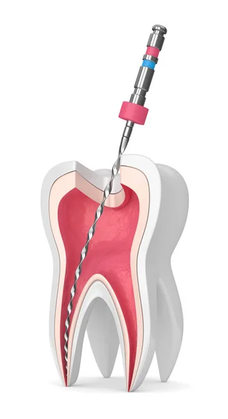 Darstellung Des Zahnes Mit Endodontischer Datei Auf Weißem Hintergrund Wurzelkanalbehandlungskonzept — Stockfoto