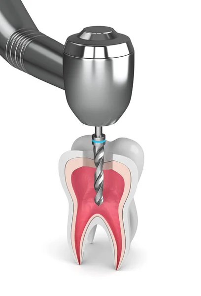 Render Tooth Dental Drill White Background — Stock Photo, Image