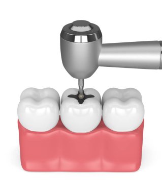 diş etleri diş, diş el probu ve beyaz bitti izole matkap ile 3D render