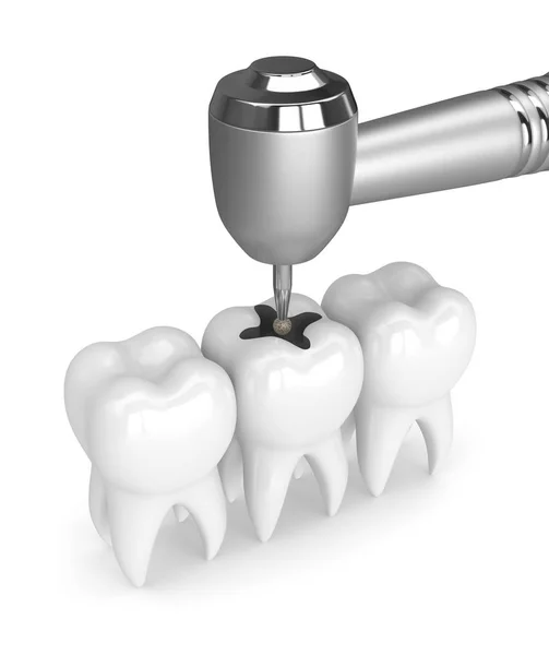 Renderização Dentes Com Peça Dentária Broca Isolada Sobre Branco — Fotografia de Stock