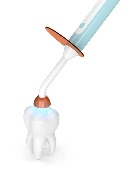 Рендеринг Лампы Полимеризации Зубов Зуба Инкрустацией Заполнения Белом Фоне — стоковое фото