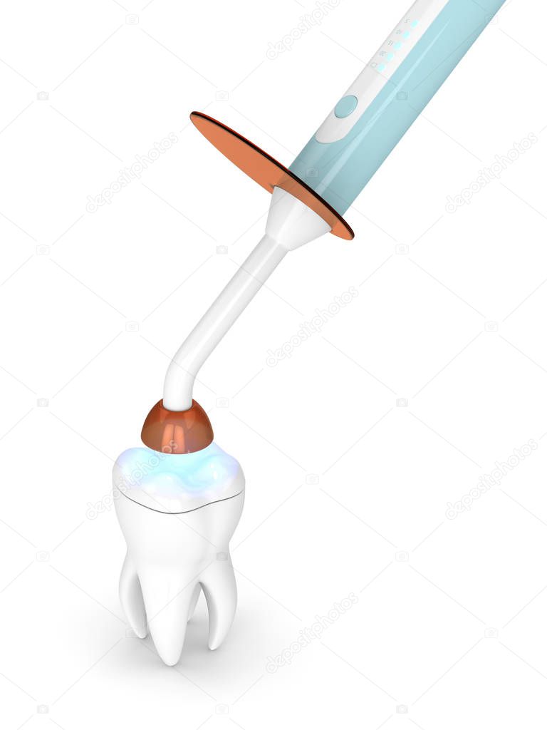 3d render of dental polymerization lamp and light cured onlay filling over white background