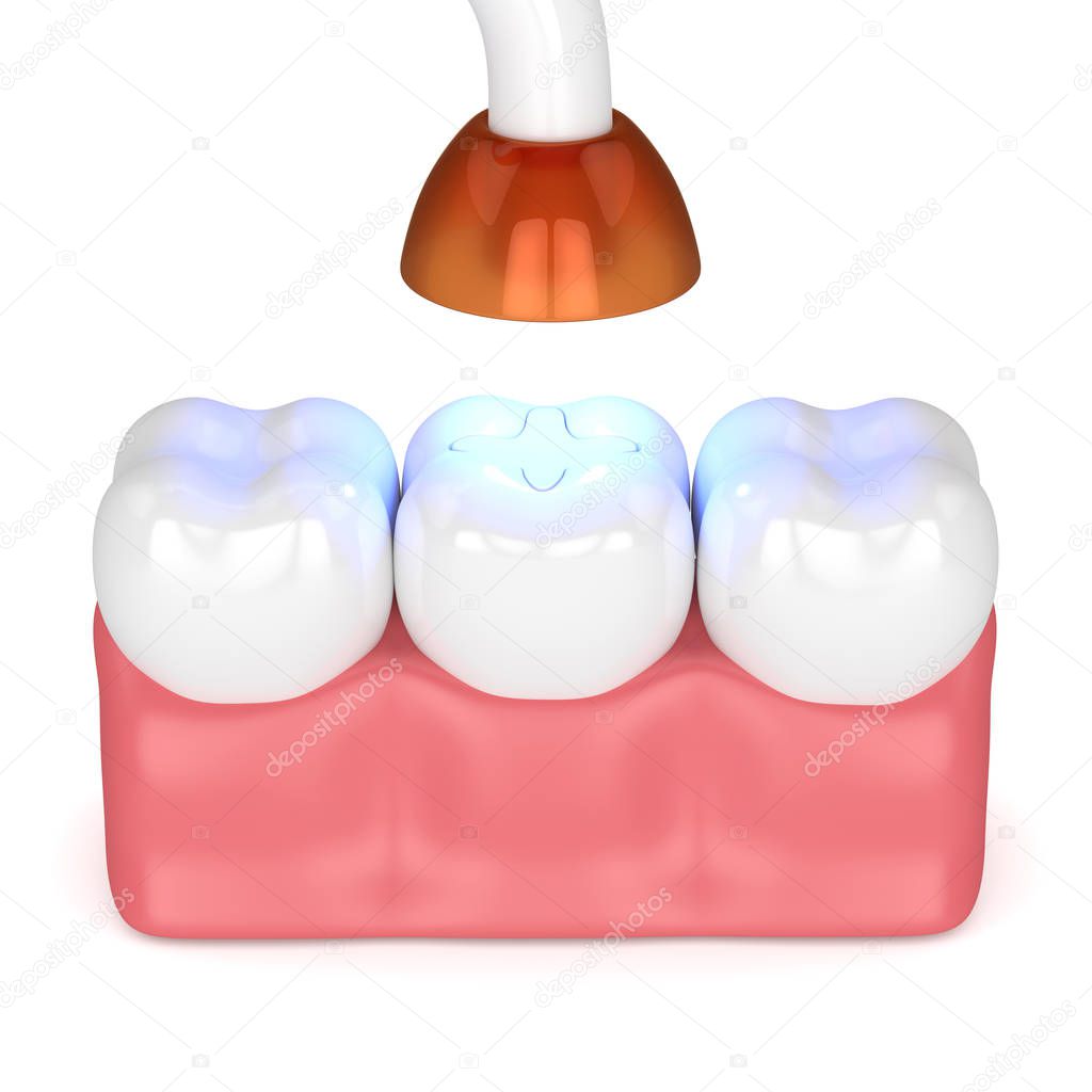3d renderizado de dientes con lámpara de polimerización dental y