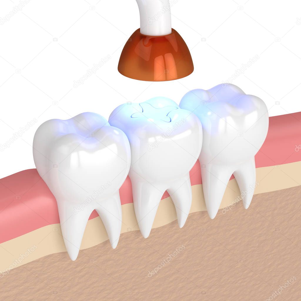3d render of teeth with dental polymerization lamp and light cur