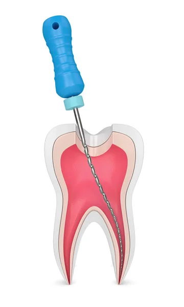 Rendering 3d del dente con file endodontico — Foto Stock