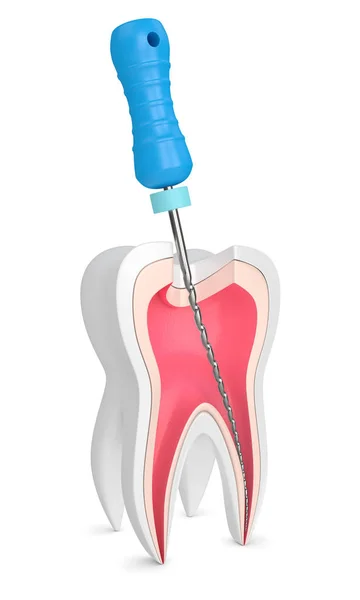 3D render van tand met endodontische bestand — Stockfoto