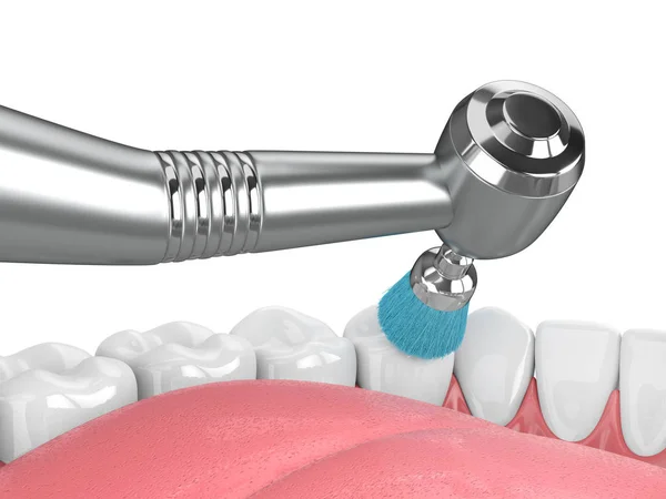 3d renderizado de mandíbula con pieza de mano dental y cepillo de pulido — Foto de Stock
