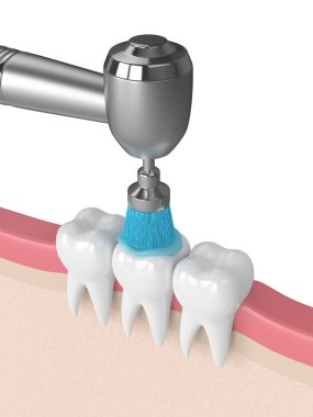 3d render of teeth with dental handpiece and polishing brush clipart