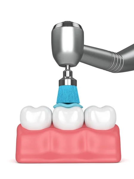 3D-Rendering der Zähne mit Zahnhandstück und Polierbürste — Stockfoto