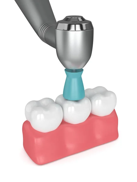 3d renderizado de dientes con pieza de mano dental y cepillo de pulido —  Fotos de Stock