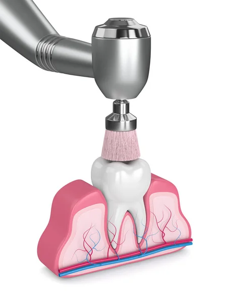 Rendering 3d del dente con manipolo dentale e spazzola lucidante — Foto Stock
