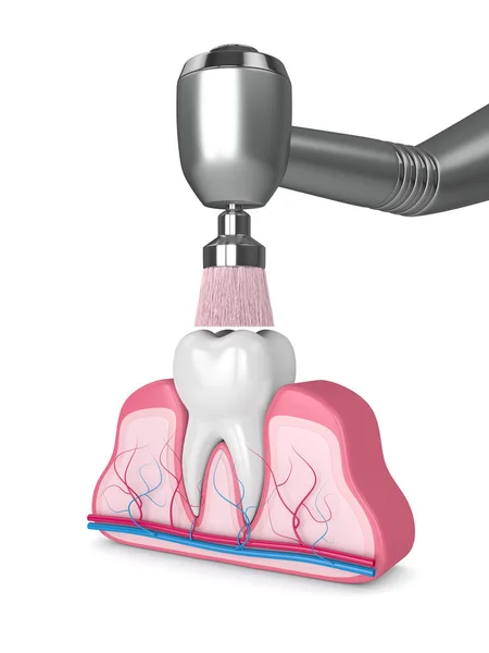 Renderowanie 3D zębów za pomocą końcówki dentystycznej i szczotki polerskiej — Zdjęcie stockowe