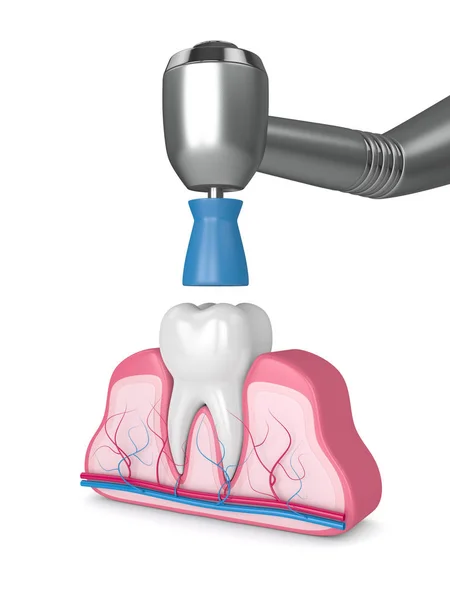 3d renderizado de diente con pieza de mano dental y pulido prophy cu —  Fotos de Stock