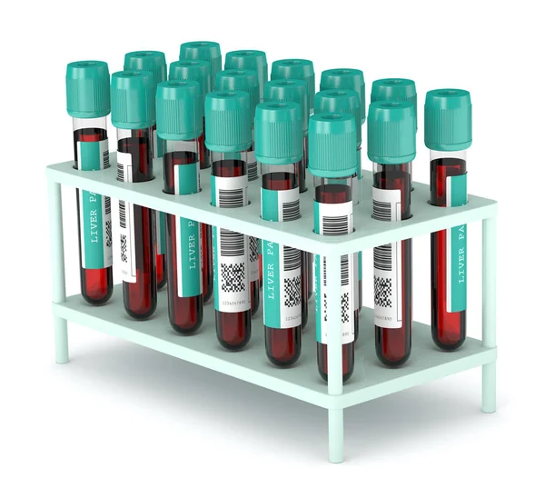 3d renderizado de los tubos de análisis de sangre del panel hepático en contenedor — Foto de Stock