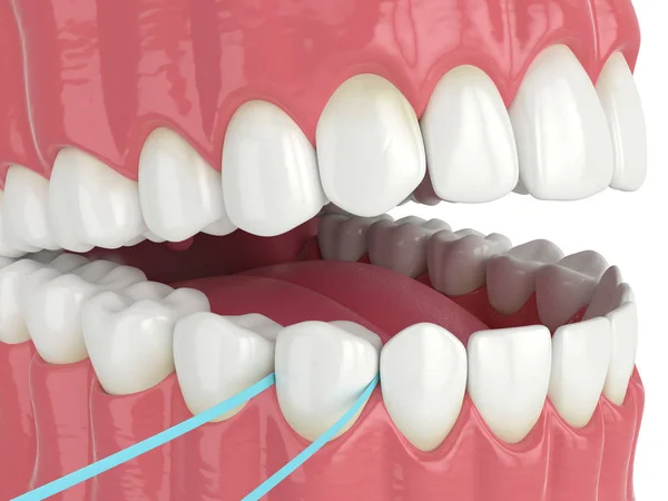 3d renderizado de mandíbula con hilo dental — Foto de Stock