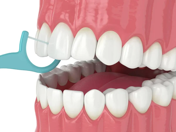 3D renderen van de kaak met tandheelkundige floss tandenstoker — Stockfoto