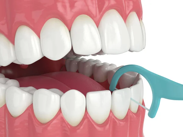 3D renderização da mandíbula com palito dental fio dental — Fotografia de Stock