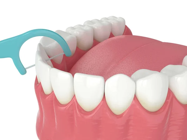 3D-Darstellung des Kiefers mit Zahnseide Zahnstocher — Stockfoto