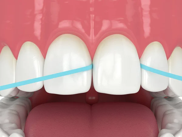 3d renderização da mandíbula com fio dental — Fotografia de Stock