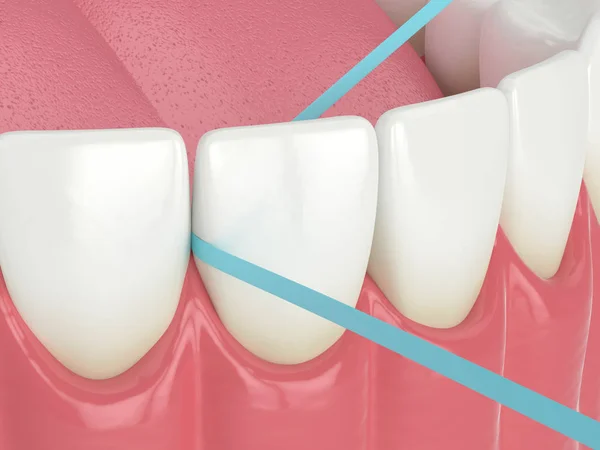 3d renderizado de mandíbula con hilo dental — Foto de Stock