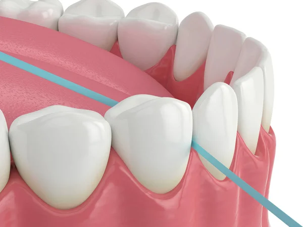 3D рендеринг челюсти с зубной нитью — стоковое фото
