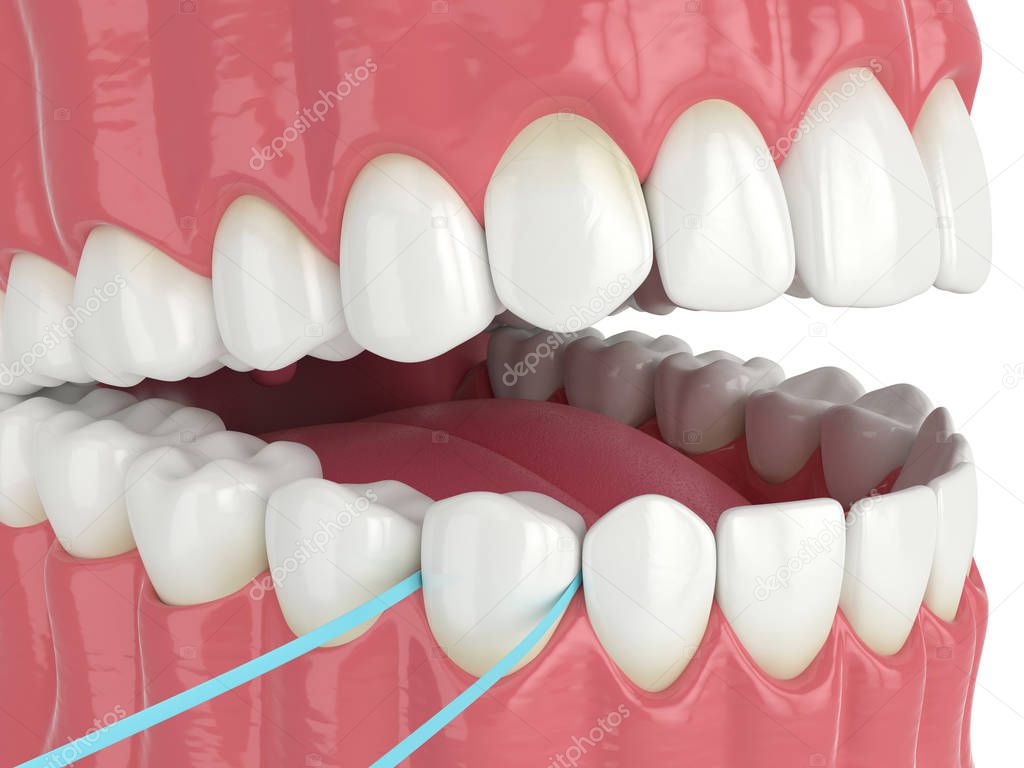 3d render of jaw with dental floss