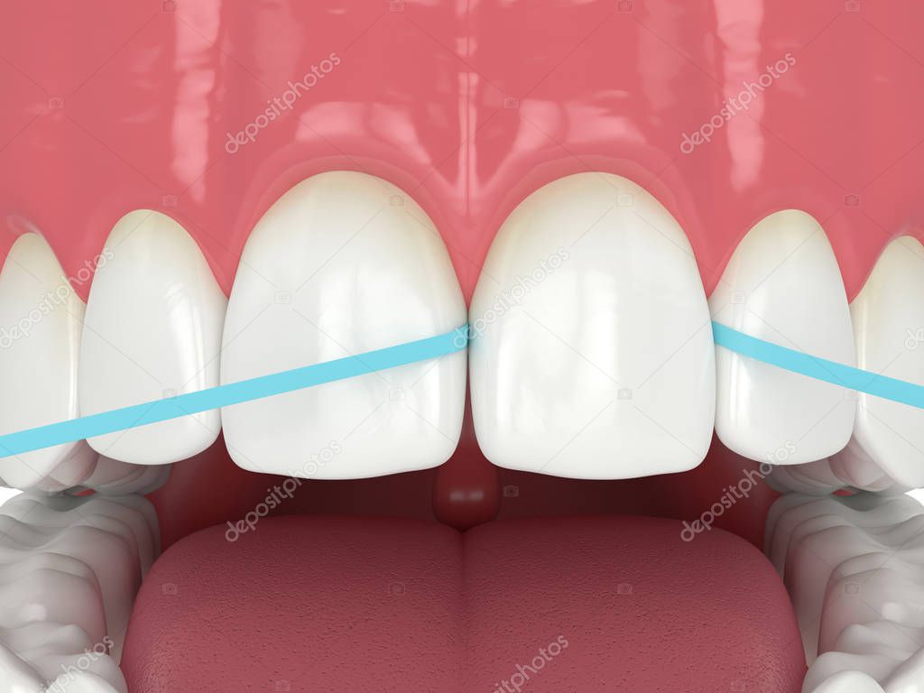3d render of jaw with dental floss