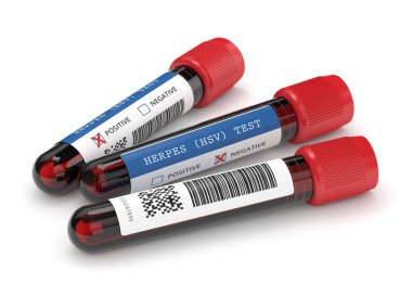 3D uçuk testi yapılmış kan örnekleri.