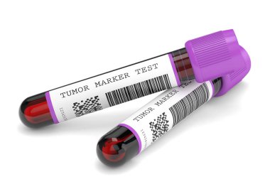 3d render of  blood samples with tumor marker test clipart