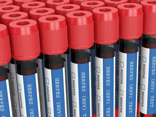 3D renderizado de muestras de sangre con prueba de herpes — Foto de Stock