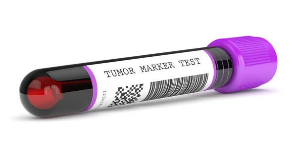 3D renderizado de la muestra de sangre con prueba de marcadores tumorales — Foto de Stock