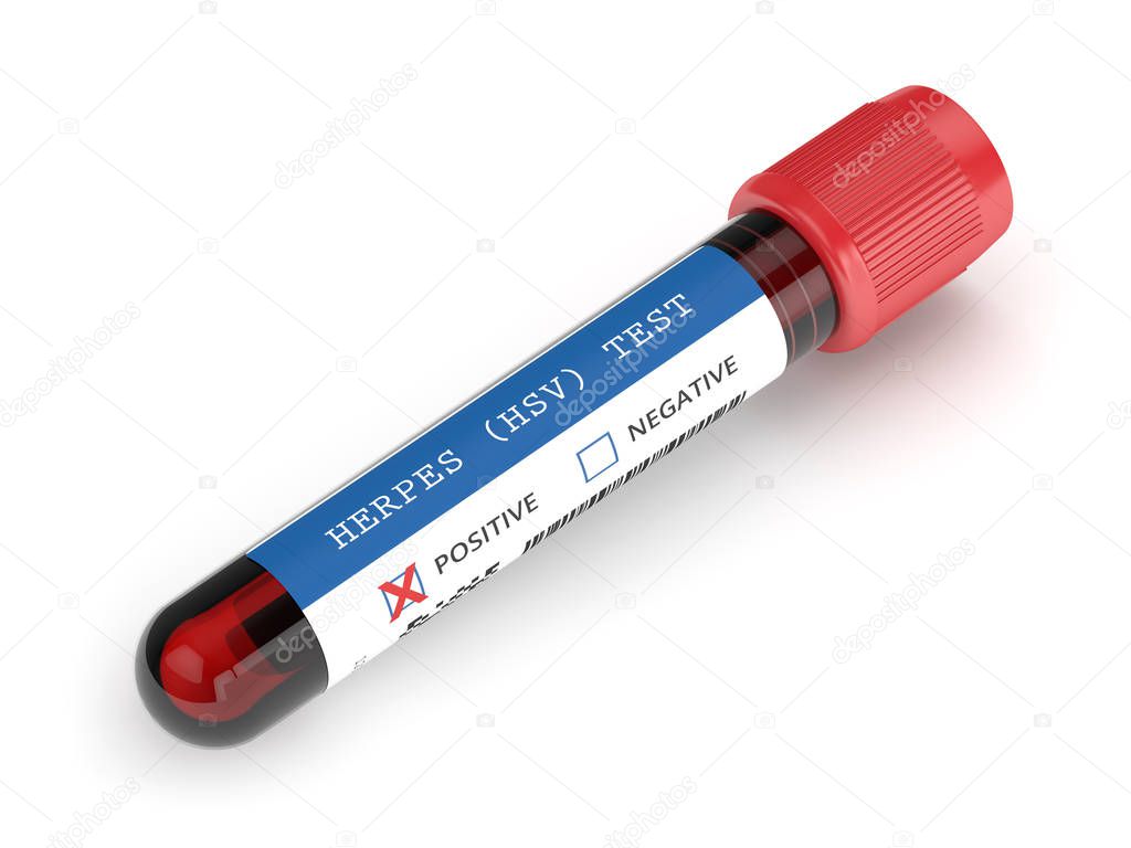 3d render of  blood sample with herpes test