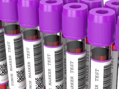 Tümör işaretleyicili 3 boyutlu kan örnekleri test edildi