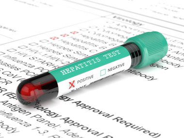 Hepatit testi yapılan 3D kan örneği