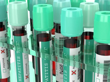 Hepatit testi yapılan 3D kan örneği