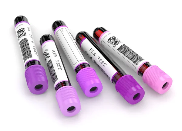Rendering 3d di campioni di sangue con test dei marcatori tumorali — Foto Stock
