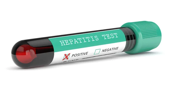 3d render of  blood samples with hepatitis test — ストック写真