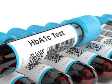 3d render of HbA1c blood tubes over white clipart