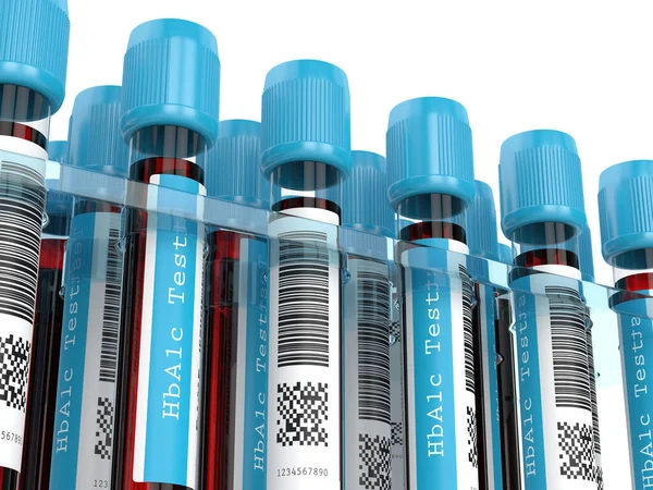 Renderização 3d de tubos de sangue HbA1c em rack — Fotografia de Stock