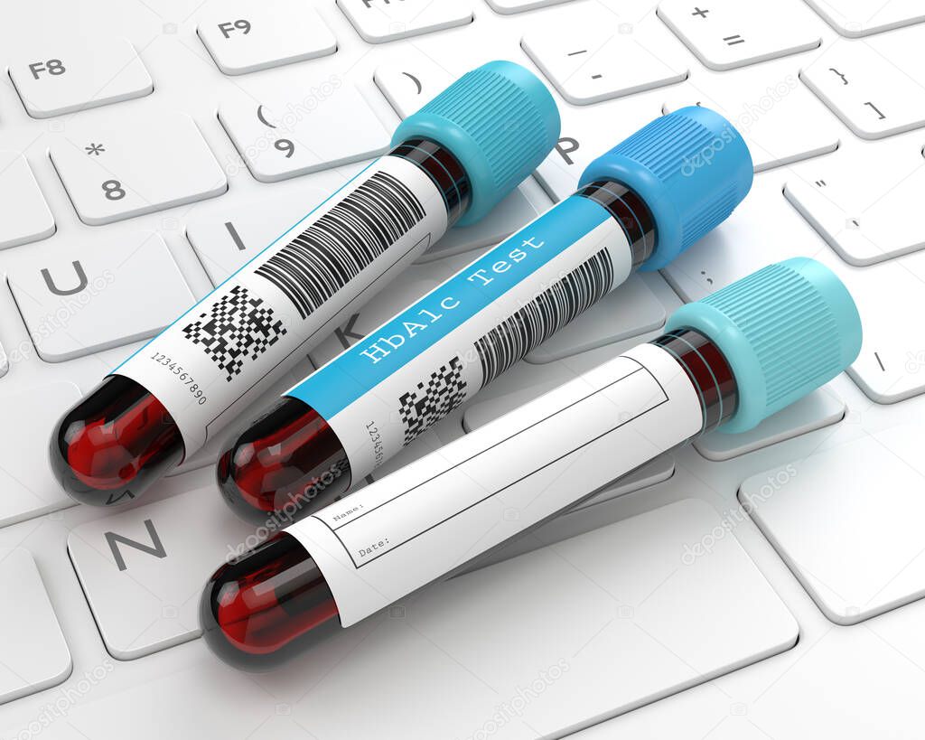 3d render of HbA1c blood tubes lying on computer keyboard