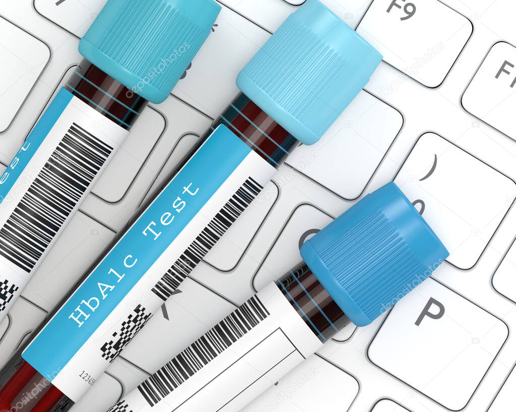 3d render of HbA1c blood tubes lying on computer keyboard
