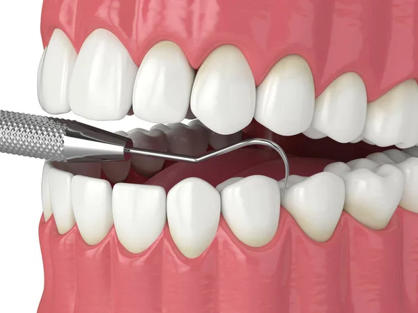Візуалізація Щелепи Дослідником Зубів Концепція Стоматологічних Інструментів Діагностики — стокове фото