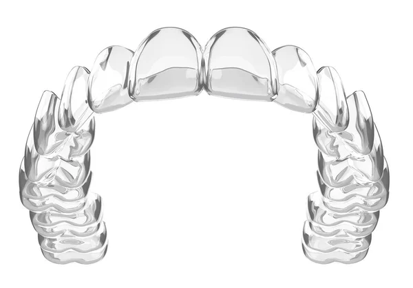 Renderização Invisalign Vácuo Removível Invisível Formado Retentor Sobre Fundo Branco — Fotografia de Stock