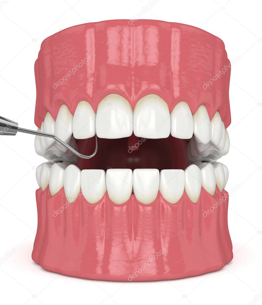 3d render of jaw with dental explorer over white background. Dental diagnostic tools concept.