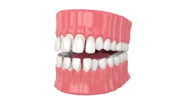 白色背景上装有牙龈的牙龈 — 图库视频影像