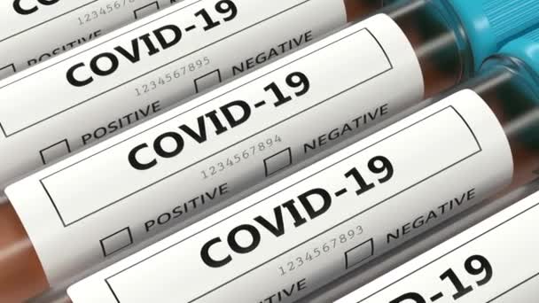 Écouvillonnage Nasal Covid Tests Laboratoire — Video