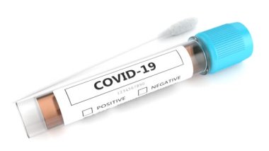 Covid-19 geniz laboratuvar testi.