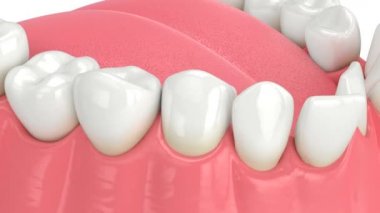 Anormal diş pozisyonu. Ortodontik tedavi kavramı. 